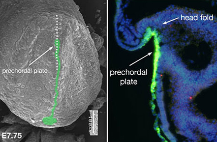 （図）7.75日齢マウス胚神経板の正中決定過程におけるソニックヘッジホッグの発現（緑）