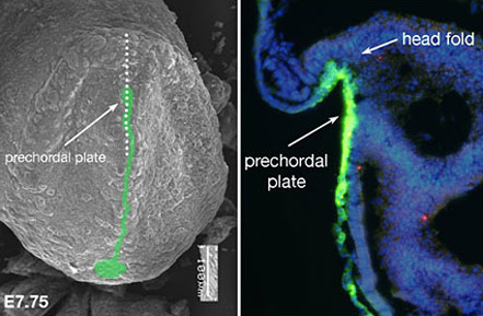 Fig.1:Expression of Sonic hedgehog (Shh) protein and the determination of the midline structure in mouse embryo